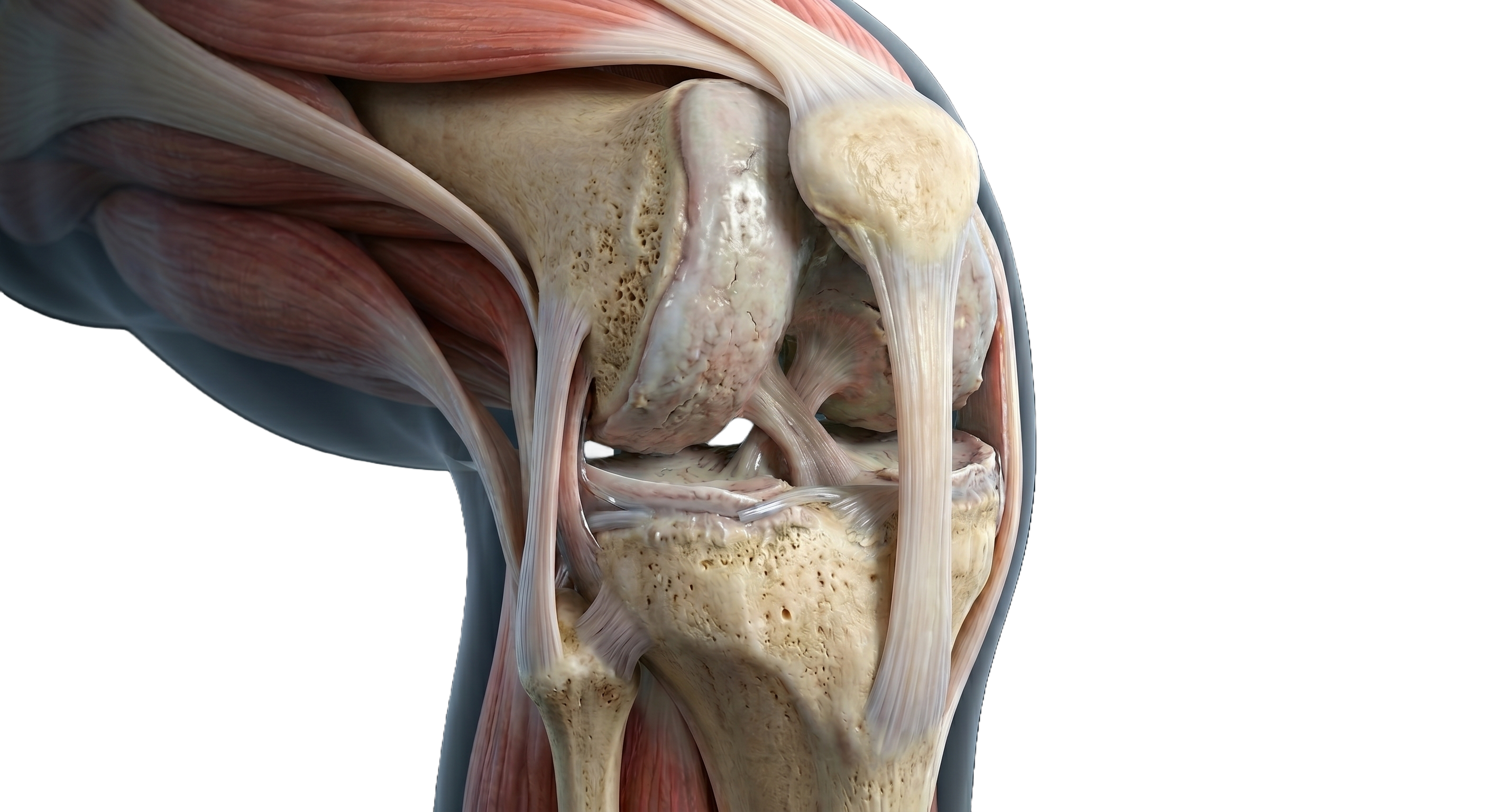 Wear and Tear Joint